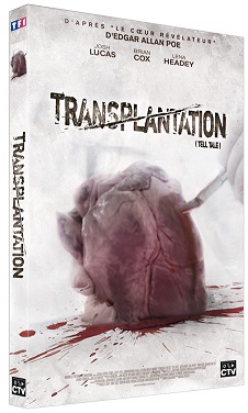 Transplantation en DVD chez CTV